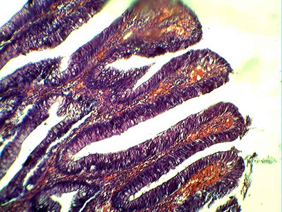 fig 4 f4